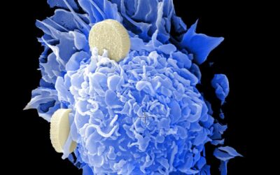 J&J Acquires Halda Therapeutics to Boost Oncology Pipeline